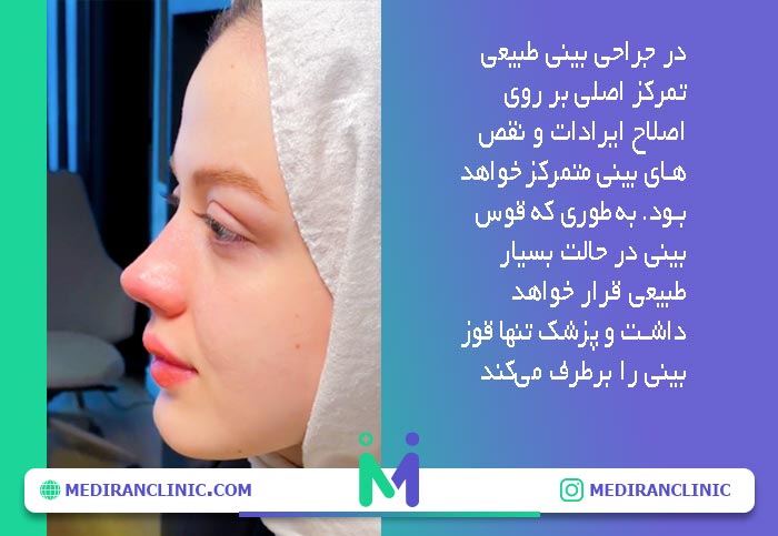 ویژگی بینی طبیعی