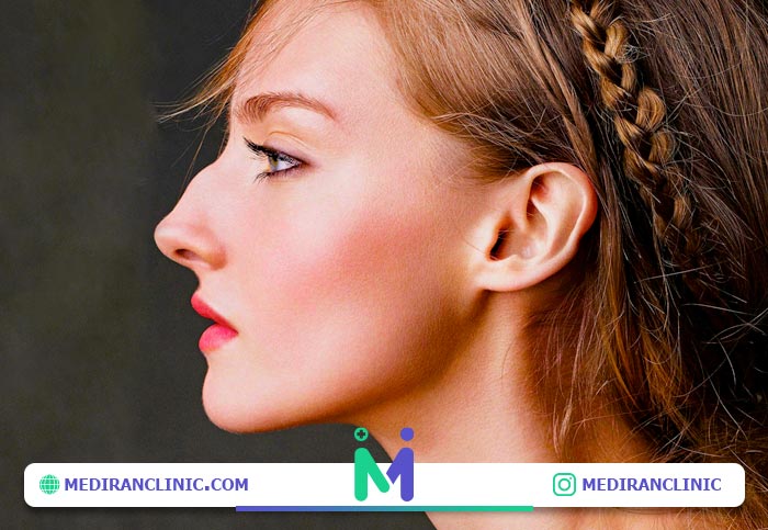 مشخصات بینی استخوانی