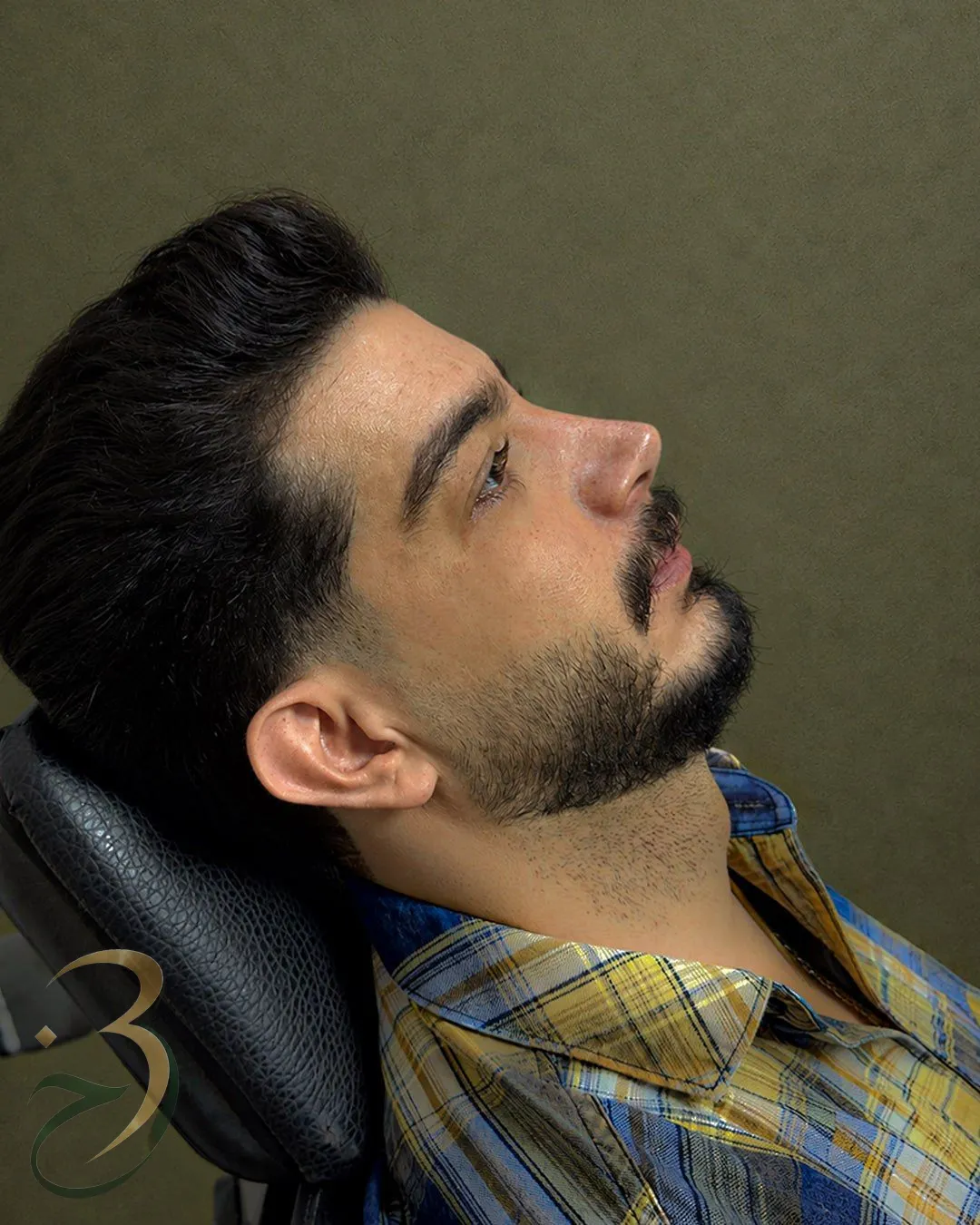 رینوپلاستی — بعد