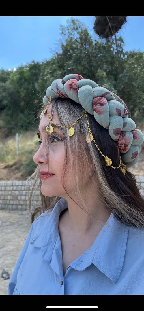 رینوپلاستی (جراحی بینی) — بعد