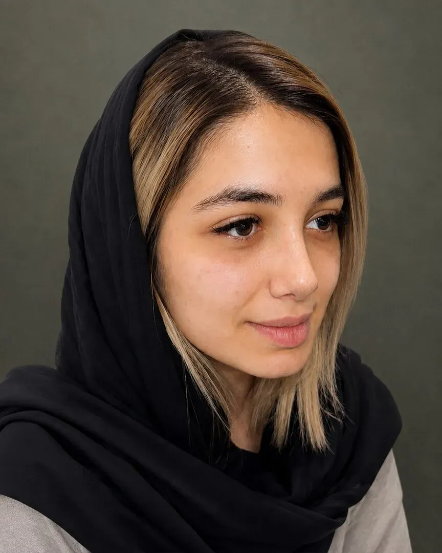 رینوپلاستی (جراحی بینی) — بعد