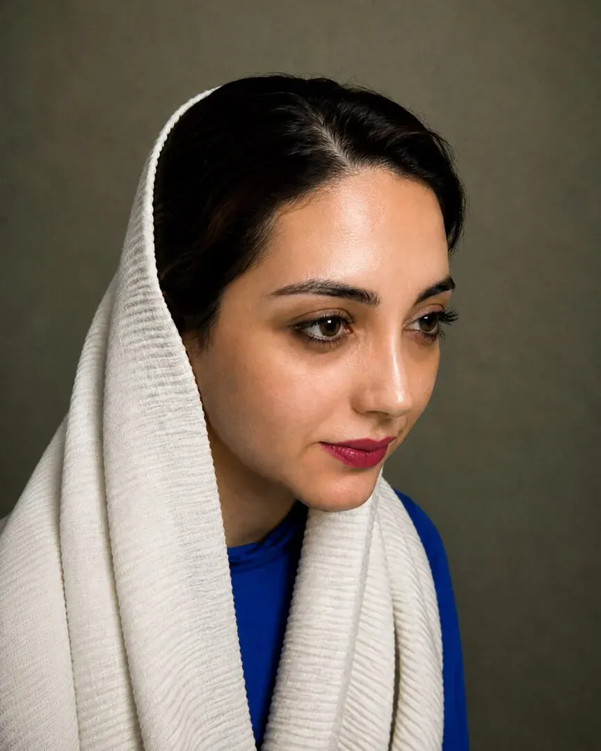 رینوپلاستی (جراحی بینی) — بعد