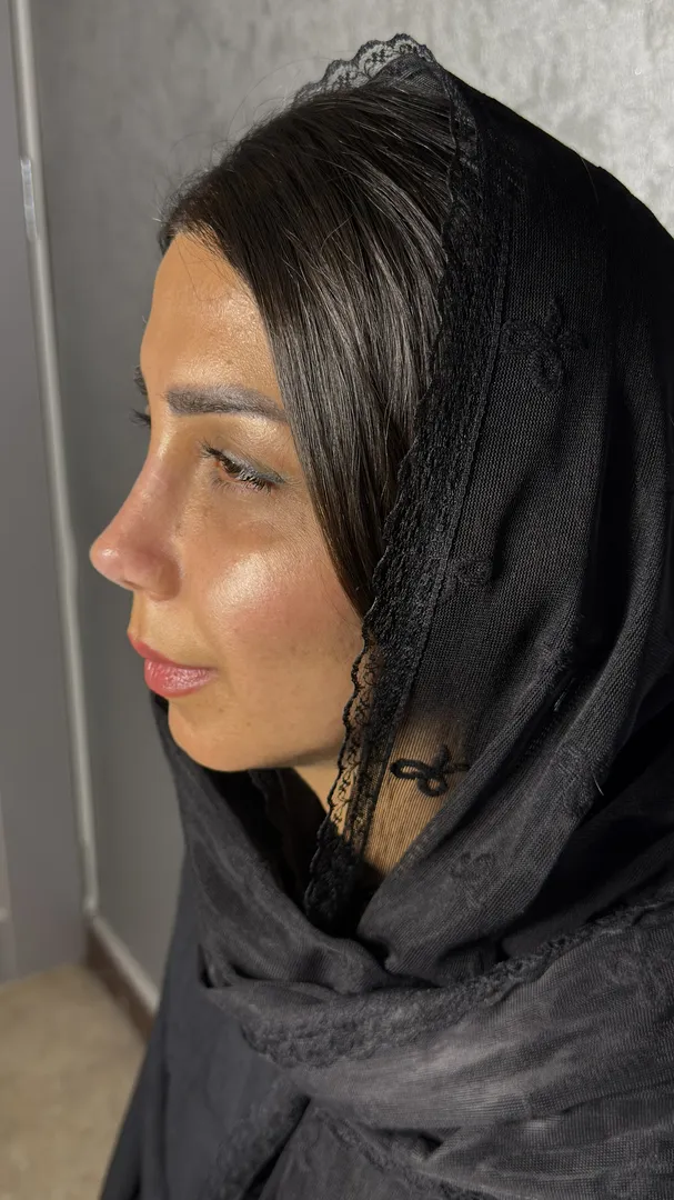 رینوپلاستی (جراحی بینی) — قبل