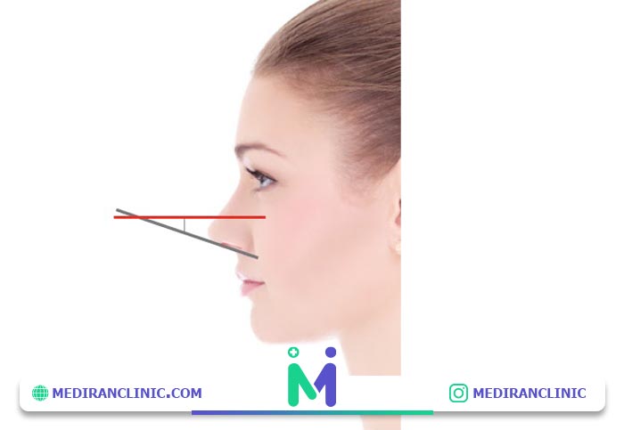 زاویه بین چشم و بینی در زیبایی شناسی عمل بینی