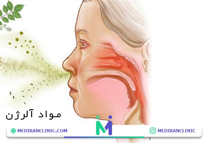 دوری از مواد آلرژن برای کنترل پولیپ بینی