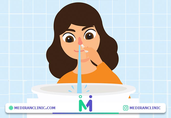 شست و شوی بینی برای جلوگیری از پولیپ بینی