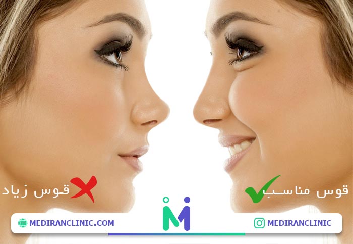 قوس بینی مناسب