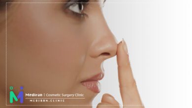 انواع فرم بینی