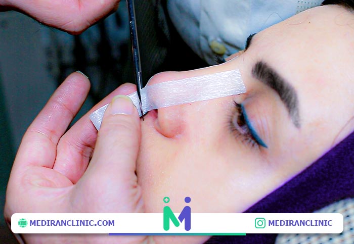 آموزش نحوه صحیح چسب زدن به بینی