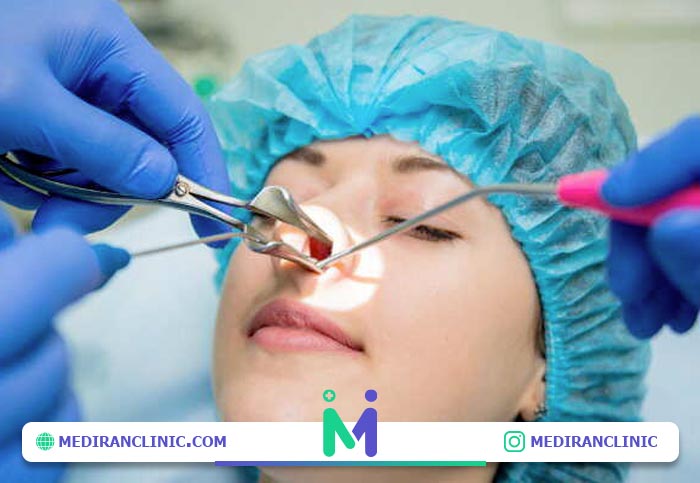 معاینه برای سپتوپلاستی