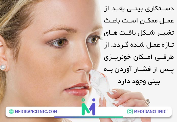 دستکاری بینی بعد عمل ممنوع