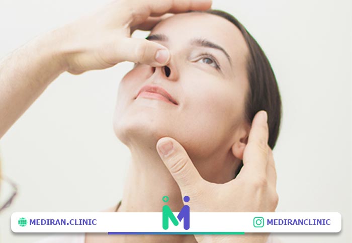 آلارپلاستی در عمل بینی