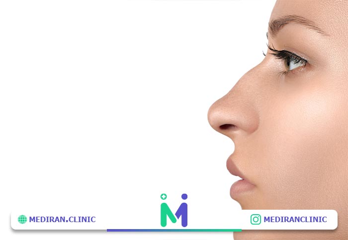 کاندید مناسب جراحی بینی