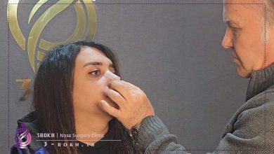 هزینه عمل بینی