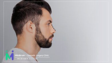 بینی طبیعی-قبل و بعد