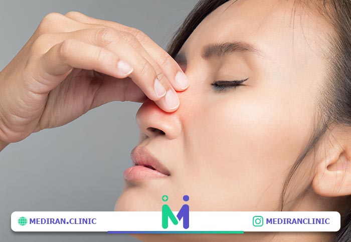 ضربه به بینی