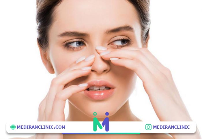 ضربه به بینی بعد از عمل بینی