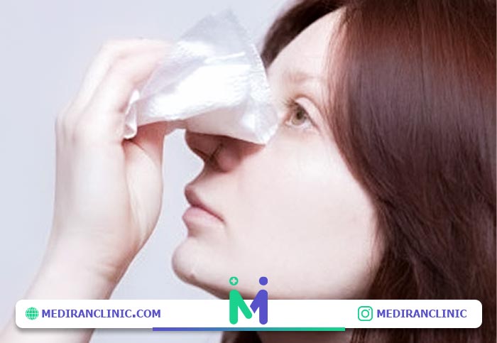 کمپرس سرد روی بینی بعد از ضربه