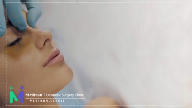 ورم و کبودی بعد از عمل بینی