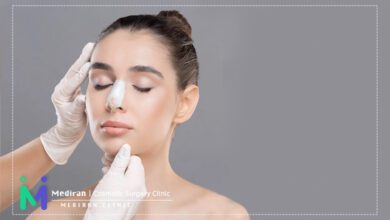 مراقبت بعد از عمل بینی