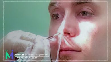 تامپون بینی