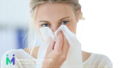 آبریزش بعد عمل بینی