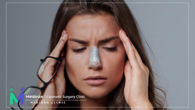 سردرد بعد عمل بینی