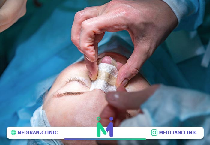 بهترین سن عمل بینی