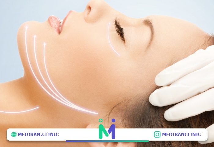 هزینه های لیفت صورت