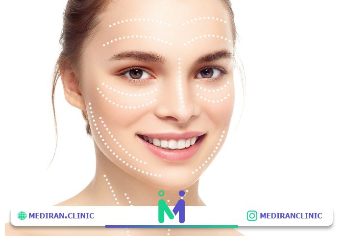 مزایای جراحی لیفت صورت نسبت به روشهای غیر جراحی چیست؟