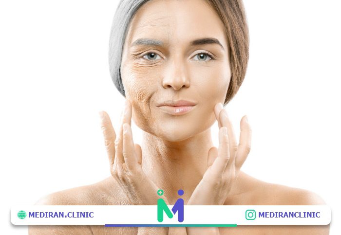 روشهای لیفت صورت کدامند؟