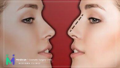 nose surgery