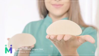 ماموپلاستی سینه