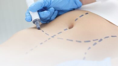 دلیل به وجود آمدن سفتی شکم بعد از لیپوماتیک