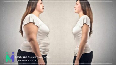 عوارض لیپوماتیک