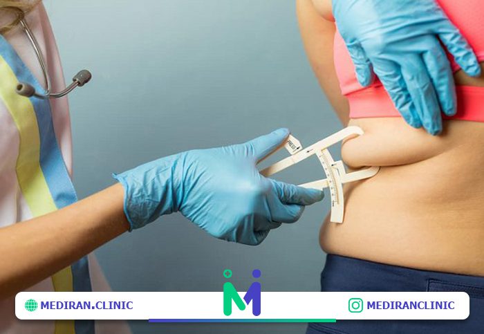 عمل زیبایی شکم نزد بهترین جراح لیپوماتیک