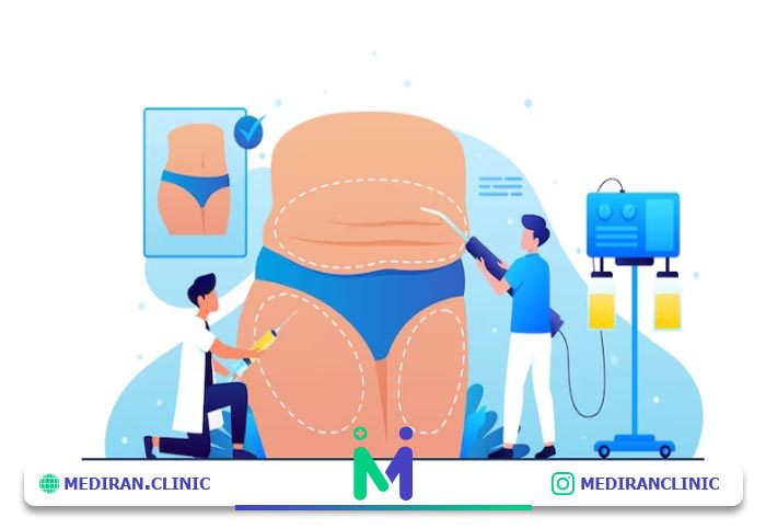 معیار بهترین جراح