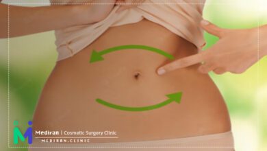 عوارض عمل ابدومینوپلاستی