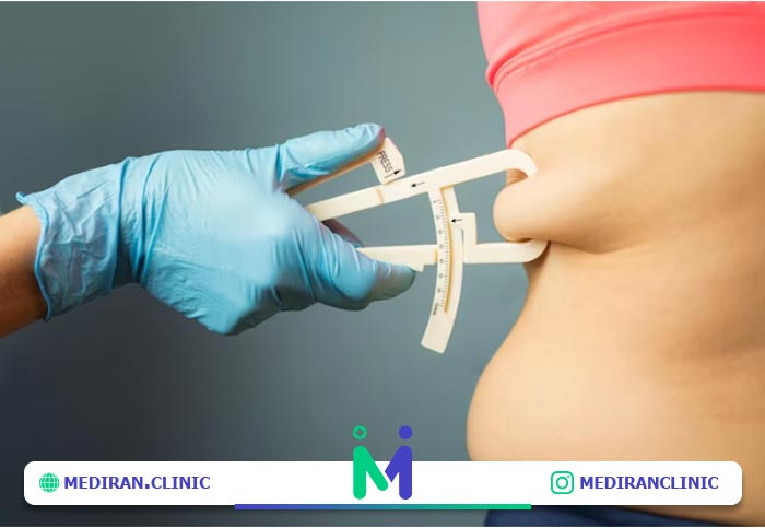 تورم بعد از عمل ابدومینوپلاستی