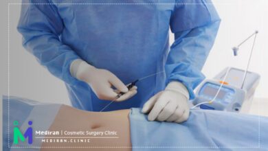 مینی ابدومینوپلاستی