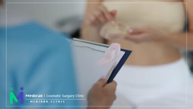 عمل جراحی ماموپلاستی