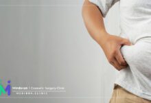 بهترین-روش-لاغری-سریع-بدون-عوارض