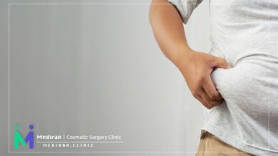 بهترین-روش-لاغری-سریع-بدون-عوارض