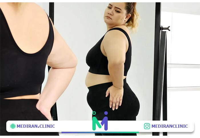 مزایای-لیپوماتیک-در-ناحیه-شکم-و-پهلو