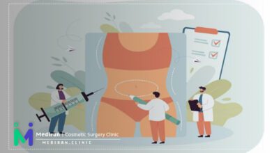 مزایای جراحی ابدومینوپلاستی