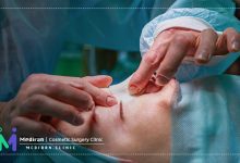 بینی فانتزی