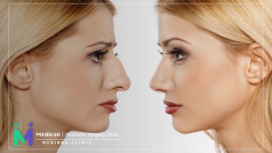 ورزش قبل عمل جراحی بینی