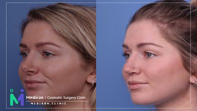 عمل ترمیم بینی