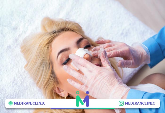 کاربرد اسپلینت