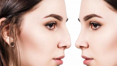 درمان خانگی انحراف بینی